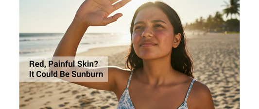 Red, Painful Skin? It Could Be Sunburn