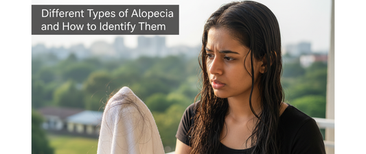 Different Types of Alopecia and How to Identify Them