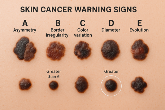 Skin Cancer Warning Signs You Should Never Ignore