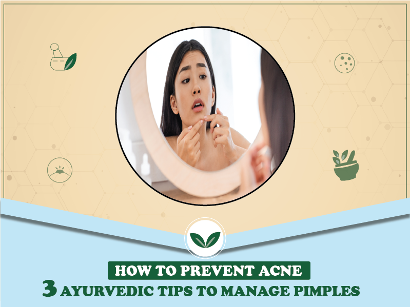 How to Prevent Acne: 3 Ayurvedic Tips to Manage Pimples