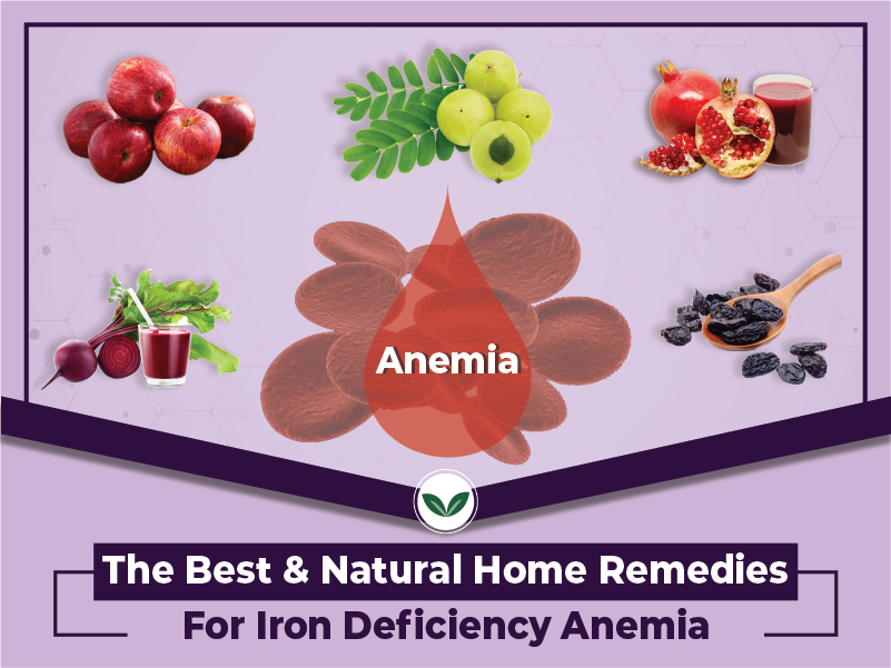 The Best & Natural Home Remedies For Iron Deficiency Anemia