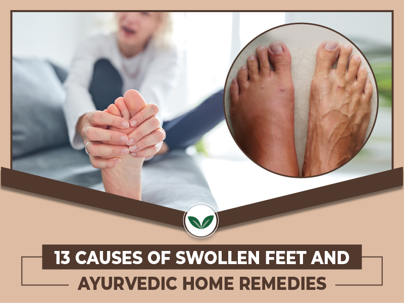 what-are-the-causes-of-swollen-feet