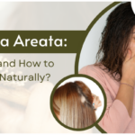 Alopecia Areata: What it is and How to Manage it Naturally?