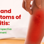 Signs and Symptoms of Cellulitis: Ayurvedic Perspective and Management