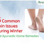 5 Common Skin Issues During Winter and Ayurvedic Home Remedies