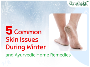 5 Common Skin Issues During Winter and Ayurvedic Home Remedies