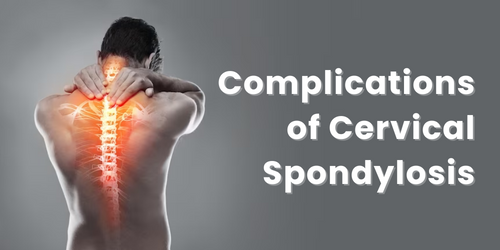 Complications of Cervical Spondylosis