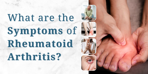What are the Symptoms of Rheumatoid Arthritis?