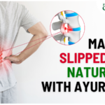 Manage Slipped Disc Naturally with Ayurveda