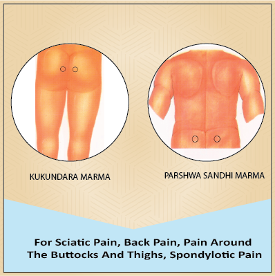  Kukundara Marma &Parshwa sandhi Marma – for Sciatic pain, back pain, pain around the buttocks and thighs, spondylotic pain