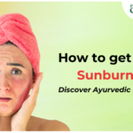 How to get rid of Sunburn fast? Discover Ayurvedic Remedies