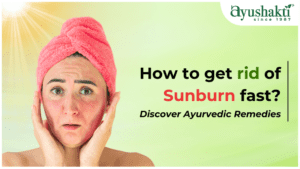 How to get rid of Sunburn fast? Discover Ayurvedic Remedies