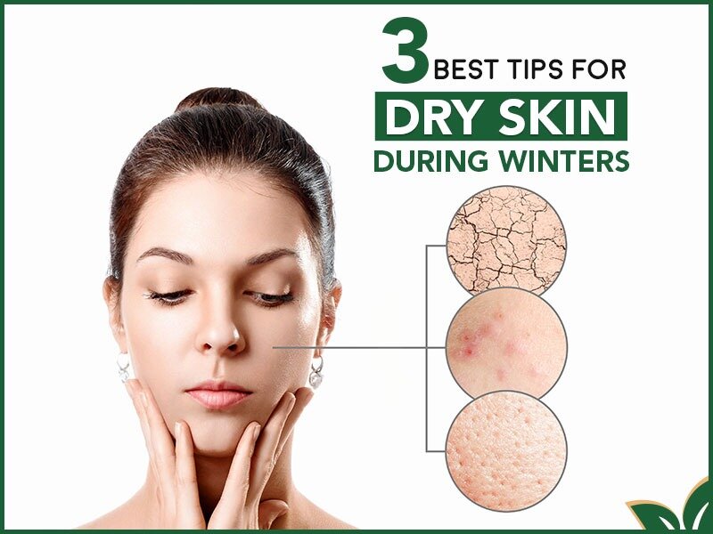 3 BEST TIPS FOR DRY SKIN DURING WINTERS